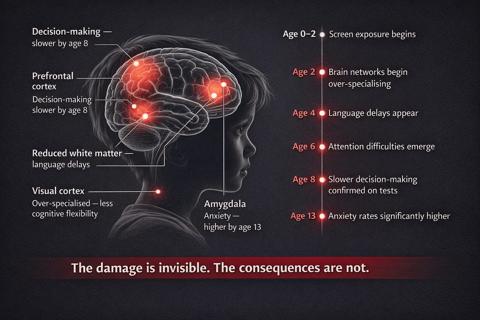 Screens vs the developing brain infographic showing brain regions affected and developmental timeline